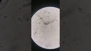 Urine sample: WBC above normal #laboratory #mls #cls #medtechstudent #microscope #medtech #urine