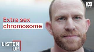 “I Was Born With An Extra Chromosome” | Listen Up | ABC Science