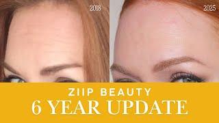 Before + After | Six Years of Using ZIIP Beauty Halo + Exclusive Discount Code