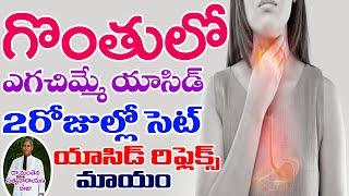 గొంతులో ఎగజిమ్మే యాసిడ్ కి 2 డేస్ లో చెక్ | How to Stop Acid Reflux | Dr Manthena Satyanarayana Raju