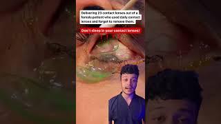 NEVER SLEEP WITH YOUR CONTACT LENSES #shorts #mbbs #neet | Raj Bhosle