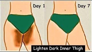 lighten private parts at home #remedies |momina