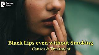 3 Reason why Lips are getting black even without smoking|Solution-Dr.Rashmi Ravinder|Doctors' Circle