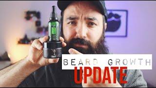 THE BEARD STRUGGLE Beard Growth UPDATE | Scam?