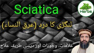 Sciatica | لنگڑی کا درد | شیاٹیکا | Hakeem Zia ur Rehman