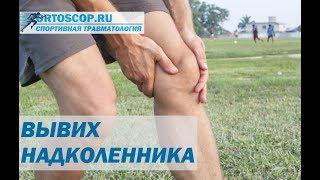 ВЫВИХ НАДКОЛЕННИКА. СПОРТИВНАЯ ТРАВМАТОЛОГИЯ