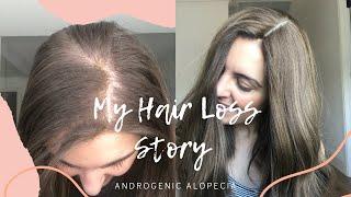 My Hair Loss Story // Androgenic Alopecia