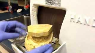 Trimming a Dental Model