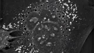 Cells in Action: Human Primary Keratinocytes at the stratum granulosum