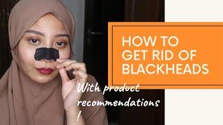 HOW TO GET RID OF BLACKHEADS | With products recommendation