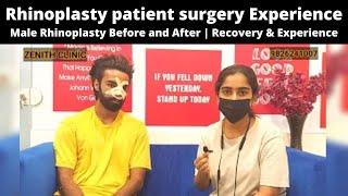 Rhinoplasty patient surgery Experience | Male Rhinoplasty Before and After | Recovery & Experience