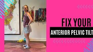 How to Fix Anterior Pelvic Tilt with Exercises