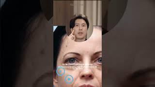 法令纹第二集：如何拯救骨骼缺陷型法令纹 #fypシ゚viral #skincare #beauty #klaesthetic #antiaging