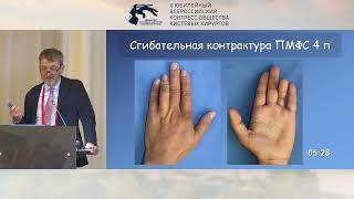 Голубев И.О.: игры с мячом. Кисть, мяч хватающая.
