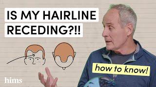 Decoding Hair Loss: Understanding the Norwood Scale