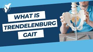 OrthoTests - What is Trendelenburg Gait? | Hip Clinical Examination