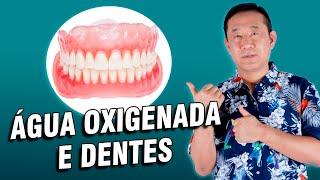 Cuidado com o uso de água oxigenada nos dentes | Peter Liu