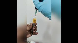 Growth Factor Concentrate (GFC) therapy to  rejuvenate the hair follicles and improve hair density.