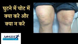 घुटने में चोट में क्या करे और क्या न करे / knee injury ya knee swelling me kin baato ka dhyan rakhe