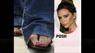 7 CELEBRITIES WITH THE UGLIEST FEET