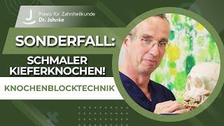 Knochenblocktechnik - Sonderfall: Schmaler Kieferknochen | Dr. Jahnke