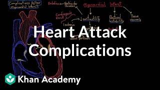 Complications after a heart attack (myocardial infarction) | NCLEX-RN | Khan Academy