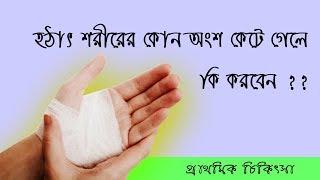 শরীরের কোন অংশে কেটে গেলে কি করবেন | First Aid Treatment for Cuts | প্রাথমিক চিকিৎসা