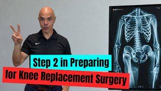 The Best Advice Before Knee Replacement Surgery