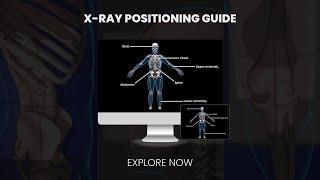 X-Ray Positioning Guide -  Medical Professionals