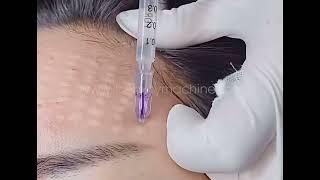 how to use 3pin/4pin Mesotherapy Needle | NanoSoft needles | derma fillers Injection needle tutorial