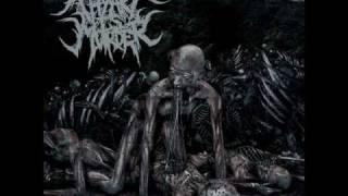 Thy Art Is Murder Parasitic Autopsy