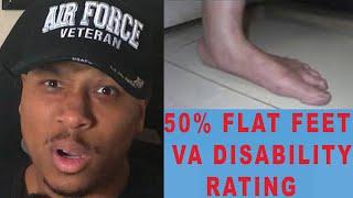 50% Flat Feet VA Disability Rating