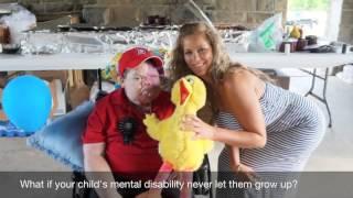 Sturge Weber Foundation -- "What If"