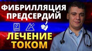 ФИБРИЛЛЯЦИЯ ПРЕДСЕРДИЙ - ЭЛЕКТРО-ИМПУЛЬСНАЯ ТЕРАПИЯ (ЭИТ) КАРДИОВЕРСИЯ