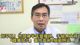 超罕見！他「頭痛半年」竟變複視、手腳無力！元凶竟是「這處發炎」醫揪出＂遭4細菌感染＂｜祝你健康