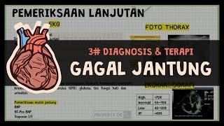 (3/3) Diagnosis & Terapi Gagal Jantung : # HEART FAILURE