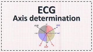 Cardiac Axis Determination | ECG Axis | Simplified