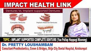 Implant Supported Complete Denture (Yaa Pullap Happagi Mawong) on IMPACT HEALTH LINK 18 FEB 2023