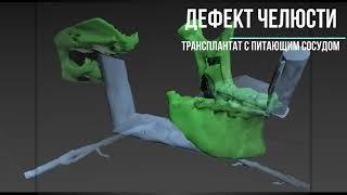 Пластические операции на лице. Реконструкция лица. Face reconstructive