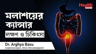 মলদ্বার এবং মলাশয় এর ক্যান্সারের লক্ষণ ও চিকিৎসা | Rectal cancer Symptoms,  diagnosis and Treatment