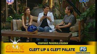 Cleft Lip and Palate