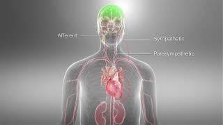 Barostim™ Baroreflex Activation Therapy Animation