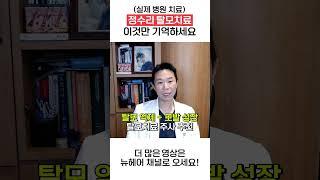 (실제 병원 치료) 정수리 탈모 치료 이것만 기억하세요