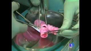 Moldes para órganos creados con células madre