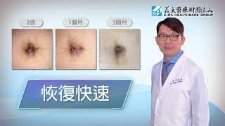 達文西外科手術系統簡介 ( 義大醫療財團法人 ) da Vinci Surgical System introduction