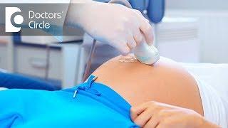 What are the various Tubal Patency tests?-Dr. Kasi Sellappan