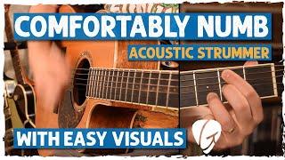 "Comfortably Numb" Acoustic Guitar Lesson + Tutorial | Easy Classic Rock - Pink Floyd