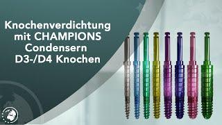 Knochenverdichtung mit CHAMPIONS Condensern D3-/D4 Knochen