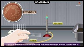 Gram Staining Procedure Animation Microbiology - Principle, Procedure, Interpretation