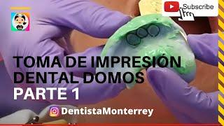 Prótesis Superior #Sobredentadura Parte1 Toma de Impersión DOMOS #protesisdental #dental